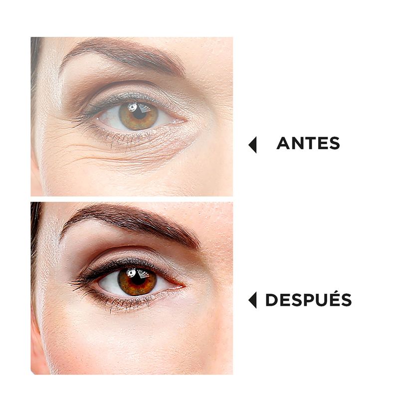 dermawand-tratamiento-de-radiofrecuencia